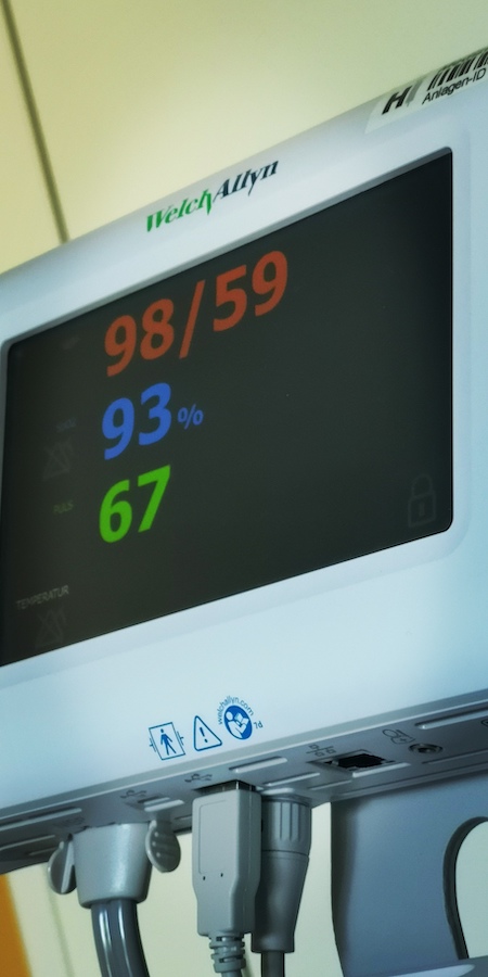 Blood pressure Blood pressure