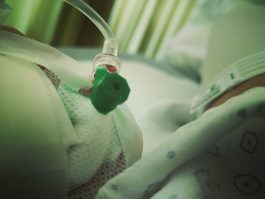 After surgery uterus After surgery uterus